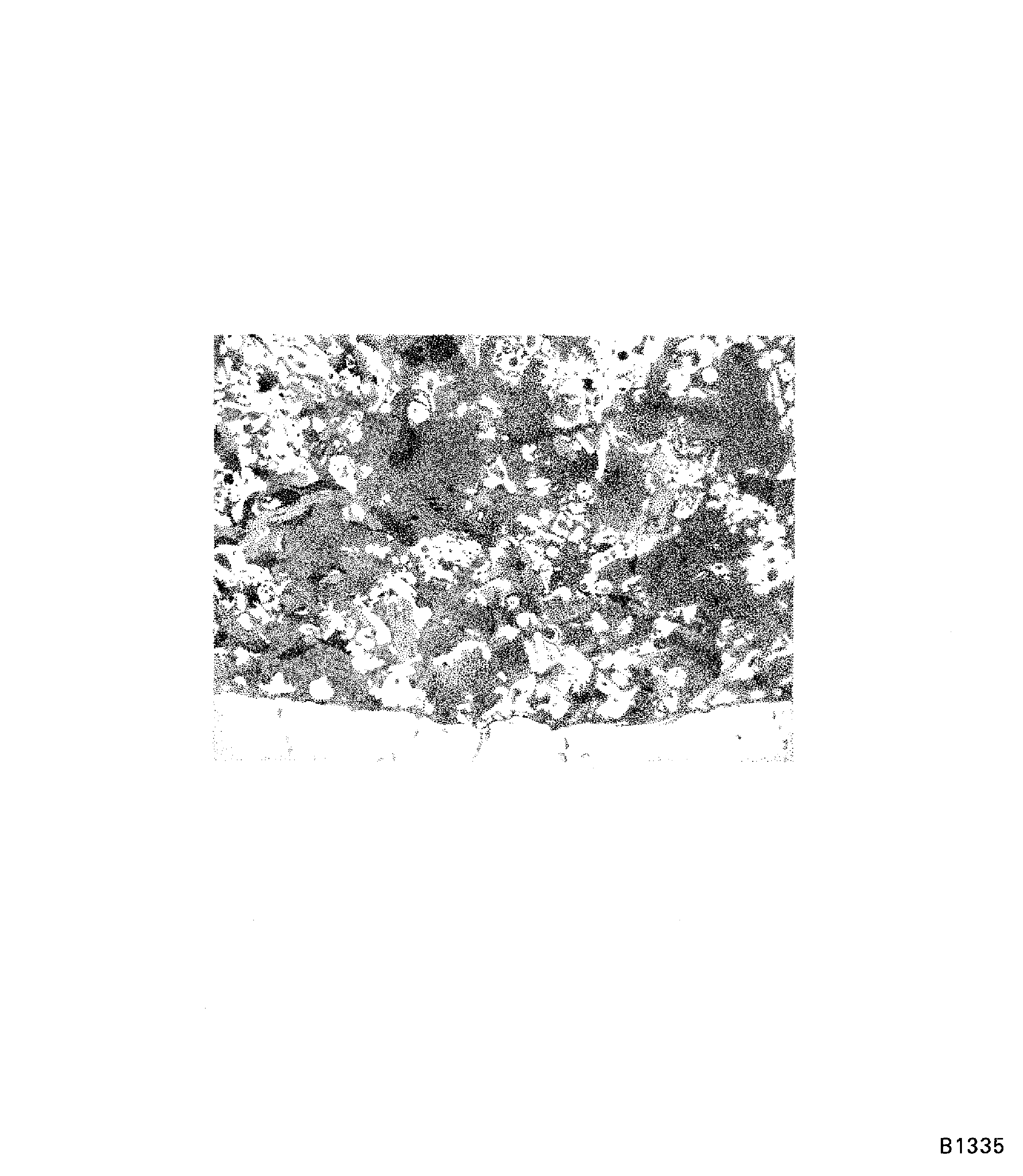 Interface condition of PWA 75-1 coating on blade roots (100X)